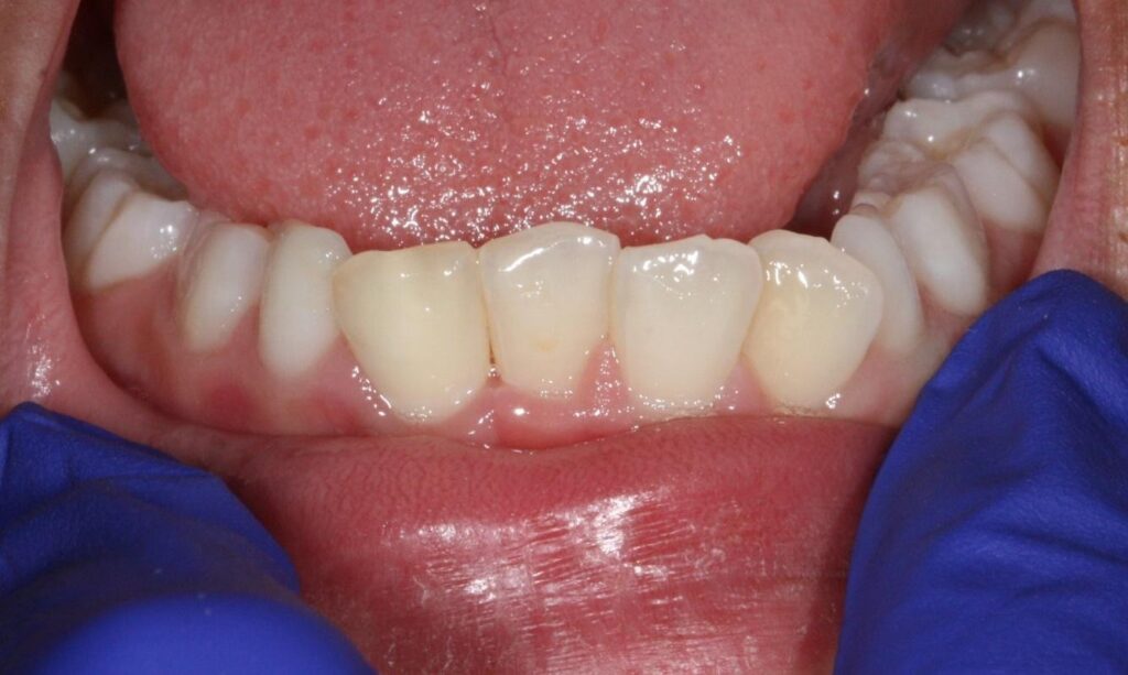 Dental Emergency