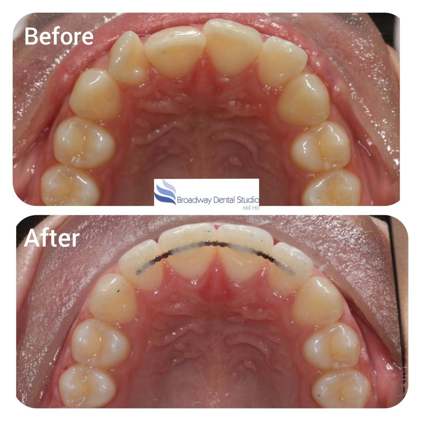 Dentist in Mill Hill: Your Local Partner for Comprehensive Dental Care
